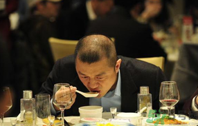 男人禿頂會遺傳嗎？男人禿頂是腎虛嗎？