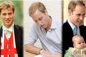 男人禿頂會遺傳嗎？男人禿頂是腎虛嗎？