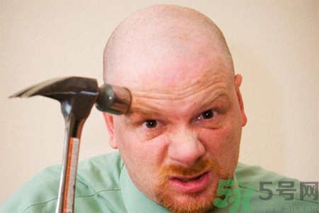 脫發(fā)的高發(fā)人群有哪些？如何預(yù)防脫發(fā)？