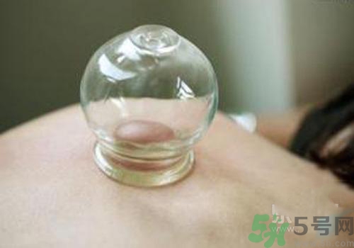拔火罐和拔氣罐哪個(gè)好？拔火罐和拔氣罐的區(qū)別
