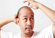 脫發(fā)的高發(fā)人群有哪些？如何預防脫發(fā)？