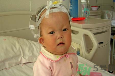 先天性心臟病可以用藥物治療嗎？