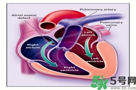 心臟病的癥狀是什么？心臟病的種類有哪些？