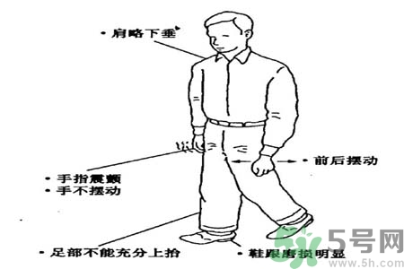 帕金森要注意哪些措施？帕金森的飲食需注意什么？