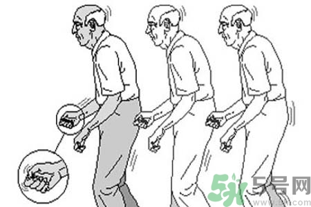 帕金森要注意哪些措施？帕金森的飲食需注意什么？