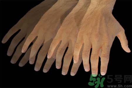 帕金森的易發(fā)人群有哪些？如何預(yù)防帕金森？