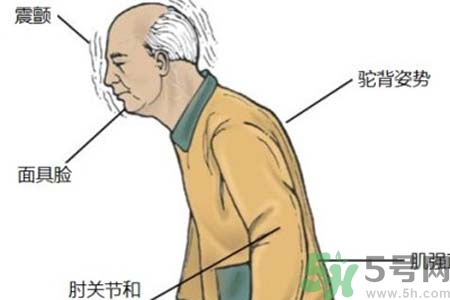 帕金森的易發(fā)人群有哪些？如何預(yù)防帕金森？