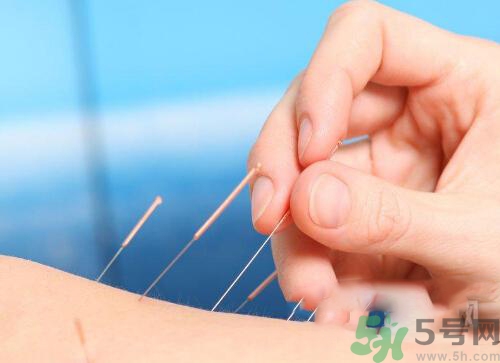 埋線減肥多少錢一次？埋線減肥的副作用