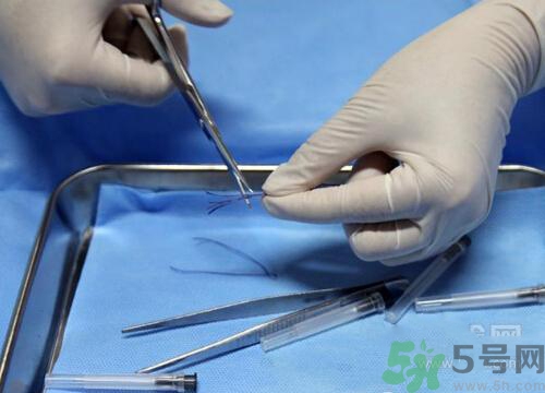 埋線減肥多少錢一次？埋線減肥的副作用