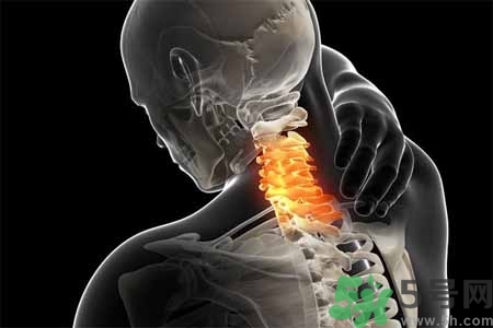 為什么年輕人容易得頸椎??？頸椎病嚴重的癥狀有哪些？
