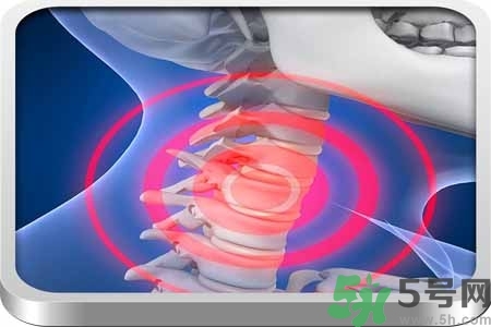 為什么年輕人容易得頸椎病？頸椎病嚴重的癥狀有哪些？