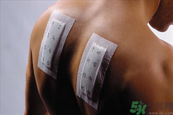 吃栗子過敏嗎?吃栗子過敏的癥狀有哪些 吃栗子過敏嗎?吃栗子過敏的癥狀有哪些