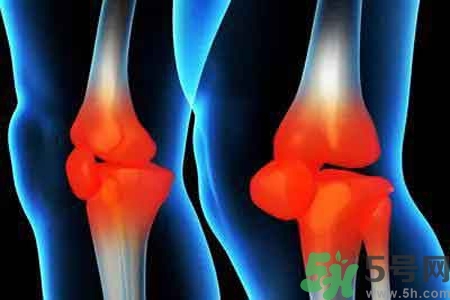 女性預(yù)防骨病的方法？女性如何預(yù)防骨?。?></p><h4 style=