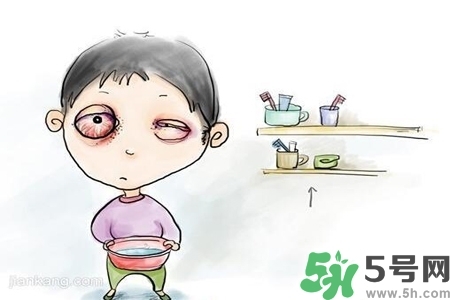 寶寶為什么會(huì)感染紅眼?。繉殞毣技t眼病如何治療？