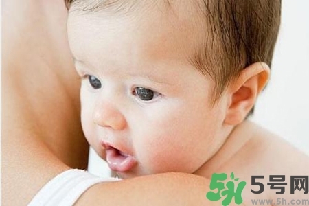 寶寶為什么會(huì)感染紅眼??？寶寶患紅眼病如何治療？