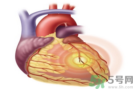 長期酗酒會引起心絞痛嗎？引起心絞痛的原因有哪些？