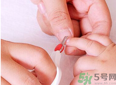 寶寶長蘚是怎么回事？寶寶長蘚怎么辦？