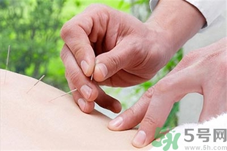 針灸時(shí)頭暈胸悶是什么原因?針灸暈針怎么辦? 針灸時(shí)頭暈胸悶是什么原因?針灸暈針怎么辦?