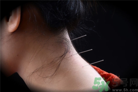 針灸時(shí)頭暈胸悶是什么原因?針灸暈針怎么辦? 針灸時(shí)頭暈胸悶是什么原因?針灸暈針怎么辦?