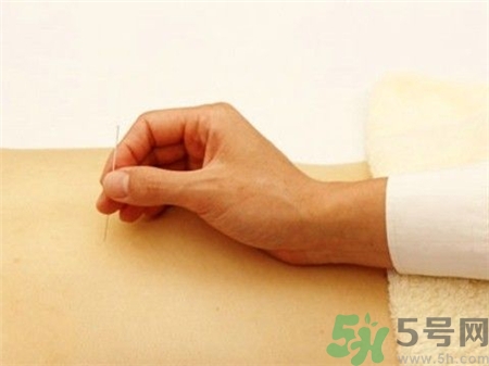 針灸后能游泳嗎?針灸游泳會怎么樣? 針灸后能游泳嗎?針灸游泳會怎么樣?