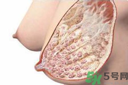 乳腺增生治療方法是什么？乳腺增生的檢查方法有哪些？