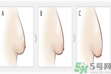 如何預防胸部松弛？吃什么能使胸部挺拔？