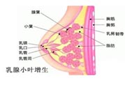 乳腺增生治療方法是什么？乳腺增生的檢查方法有哪些？