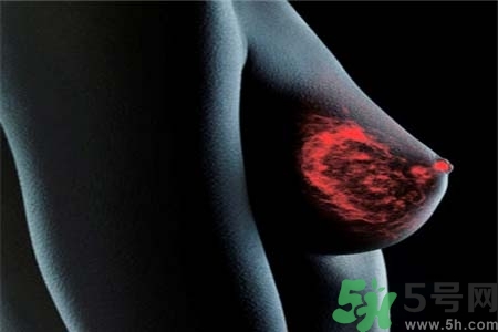 乳房上有硬塊怎么辦？乳房有硬塊的病因是什么？