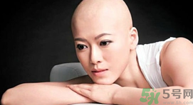 乳腺癌切除后要化療嗎？乳腺癌切除后會復發(fā)嗎？