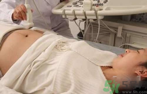 孕婦做b超要空腹嗎？孕婦做b超要不要空腹？