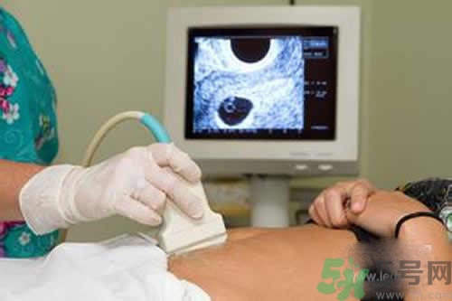孕婦做b超要空腹嗎？孕婦做b超要不要空腹？