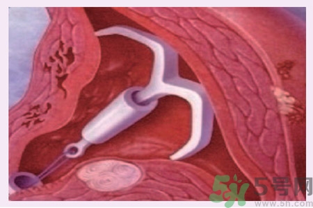 什么是自然避孕法？如何能知道自己的孕期？