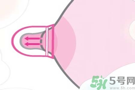 乳頭內(nèi)陷能不能喂奶？乳頭凹陷怎樣哺乳？