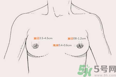 乳頭內(nèi)陷能不能喂奶？乳頭凹陷怎樣哺乳？