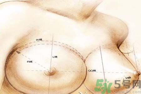 乳頭內(nèi)陷可以用吸奶器嗎？乳頭內(nèi)陷能不能用吸奶器？