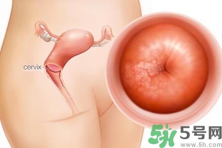 陰道出血癥狀有哪些？陰道出血需注意什么問題？