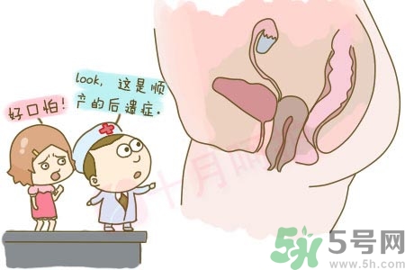 女性陰道松弛的原因是什么？女性陰道松弛怎么辦？