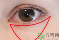 如何快速消除眼袋?快速消除眼袋的小竅門 如何快速消除眼袋?快速消除眼袋的小竅門