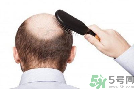 男性衰老的年齡段是什么？各年齡段男性抗衰老法則