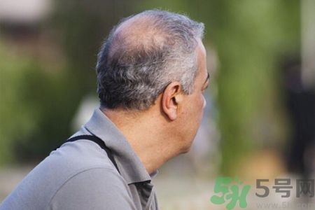 男性更年期的表現(xiàn)有哪些？怎么判斷男性更年期？