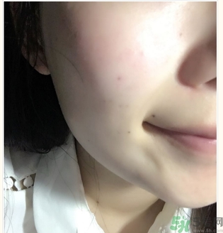 麗得姿面膜適合孕婦可以用嗎？麗得姿面膜哪些孕婦可以用？