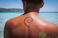 后背長痘能拔罐嗎?拔罐能祛痘嗎 后背長痘能拔罐嗎?拔罐能祛痘嗎