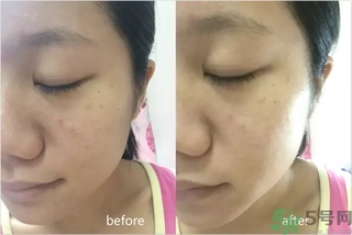 rilastil面膜使用方法 維納斯蒂爾面膜怎么用？