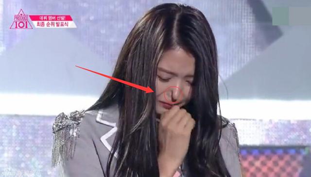 任娜英鼻子塌陷 整容鼻子容易塌陷嗎？