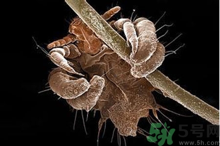 引起外陰瘙癢的疾病有哪些？治療外陰瘙癢的偏方有哪些？