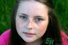 長(zhǎng)雀斑能吃黑豆嗎?雀斑吃黑豆好嗎 長(zhǎng)雀斑能吃黑豆嗎?雀斑吃黑豆好嗎