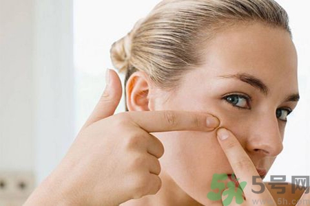 太陽(yáng)穴長(zhǎng)痘是怎么回事？太陽(yáng)穴長(zhǎng)痘的原因是什么？