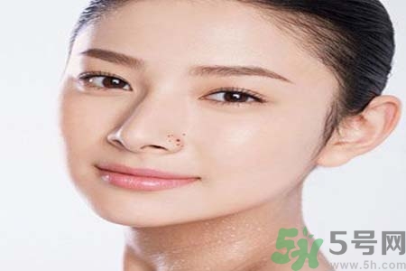 太陽(yáng)穴長(zhǎng)痘怎么辦？如何祛除太陽(yáng)穴上的痘痘？