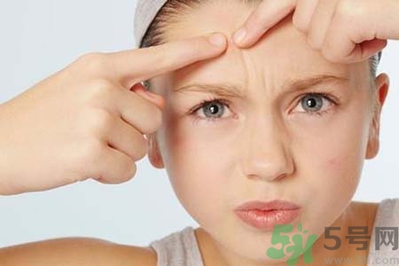 鼻翼長痘痘怎么辦？鼻翼長痘解決方法有哪些？