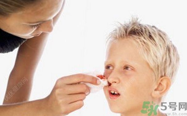 15歲男孩可以刮胡子嗎？15歲男孩經(jīng)常流鼻血怎么回事？